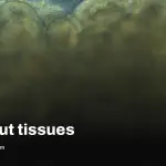 Intero Biosystems GastroScreen wins Disrupt 2026 top prize
