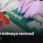 Pig kidneys revived after a year in cold storage, a sign cryopreservation could reshape transplants